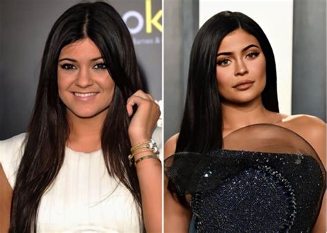 kylie jenner before and after.